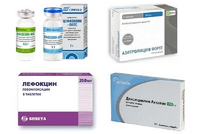 Лучшие антибиотики при кашле, топ-10 рейтинг антибиотиков